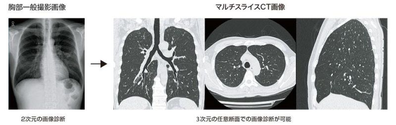 CT撮影画像
