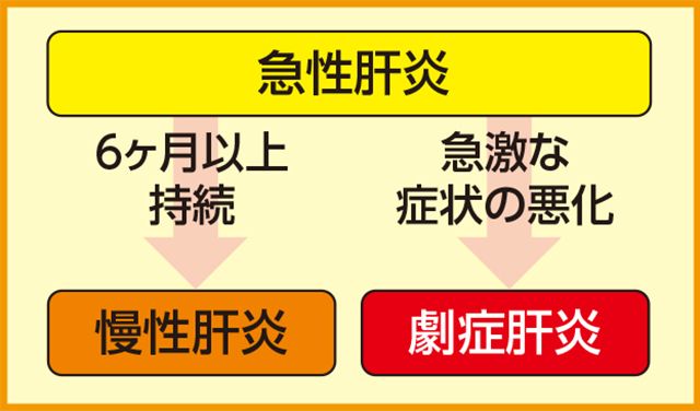 急性肝炎の悪化解説イラスト