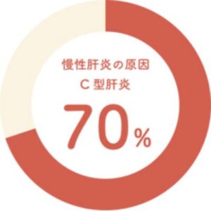 慢性肝炎の原因