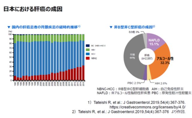 日本における肝がんの成因
