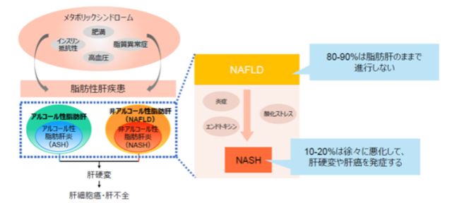 メタボリックシンドローム、脂肪性肝疾患、NAFLD、NASHの関連図