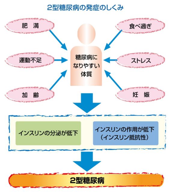 2型糖尿病の発症のしくみ